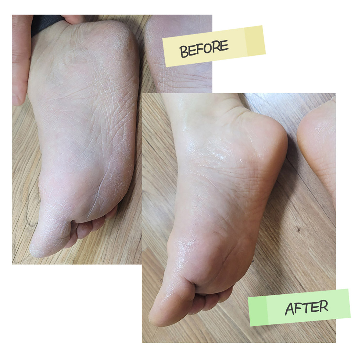 Крем за крака Chamos Cosmetics
