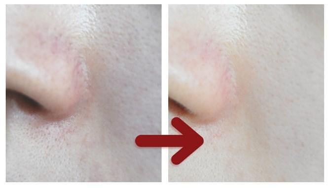 Серум за лице Chamos Cosmetics