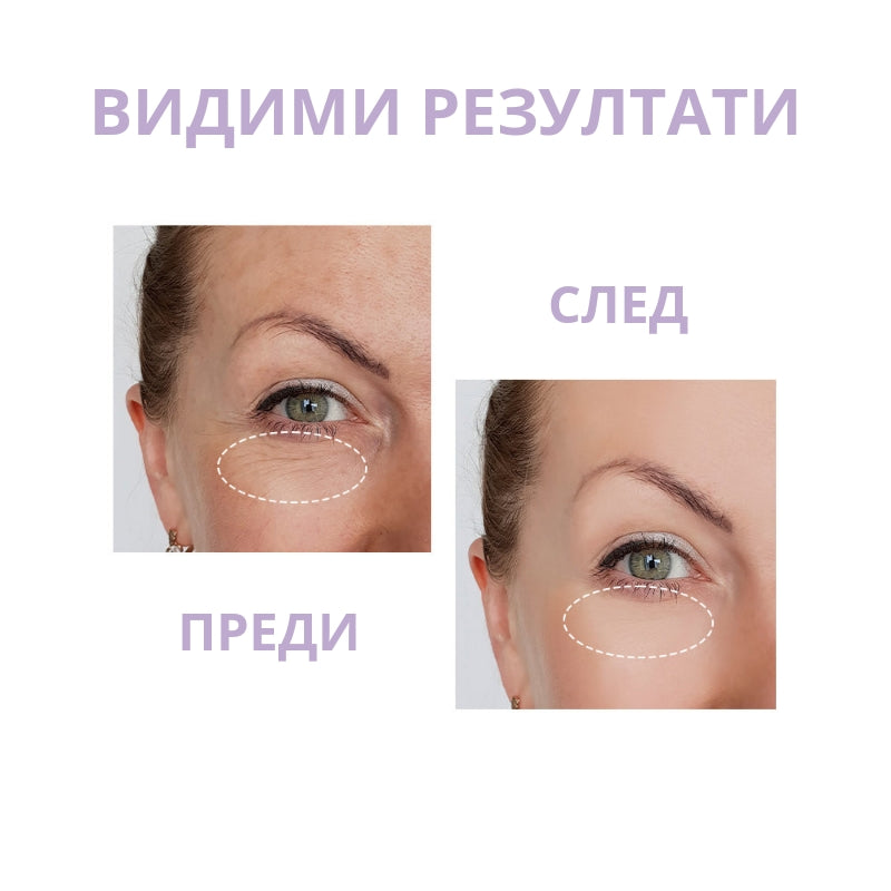 Околоочен крем OOTD