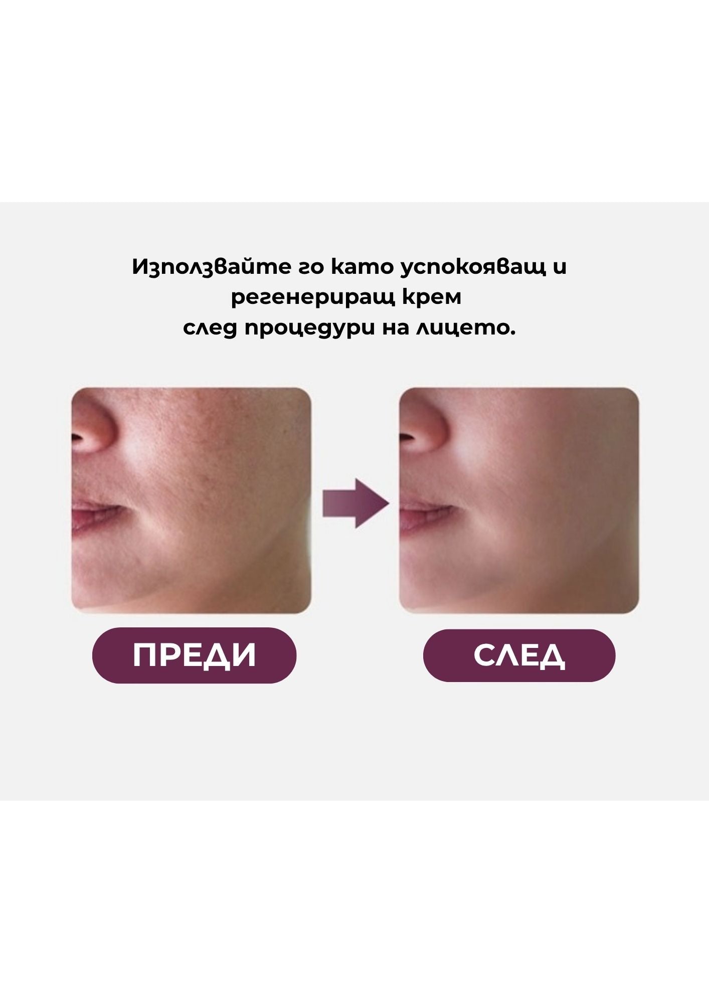 Крем за лице POUR LA PEAU