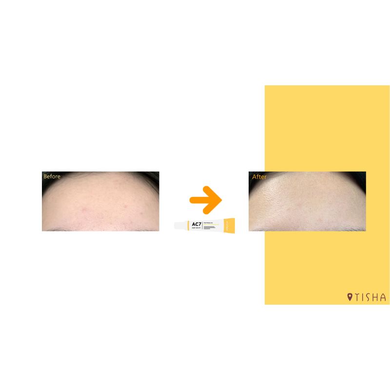 Крем за акне Dr. Tisha AC7