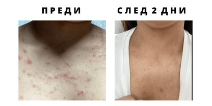 Крем за акне Dr. Tisha AC7